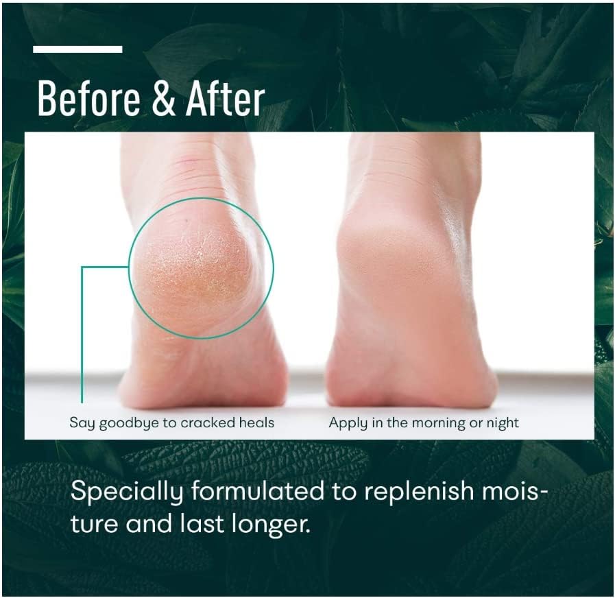 Ellocy Urea 40% foot cream fragrance-free label on packaging.