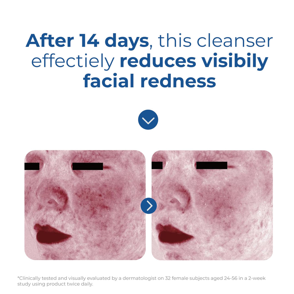 Calming effect suggested by redness-reduction notes in EltaMD cleanser for sensitive skin.