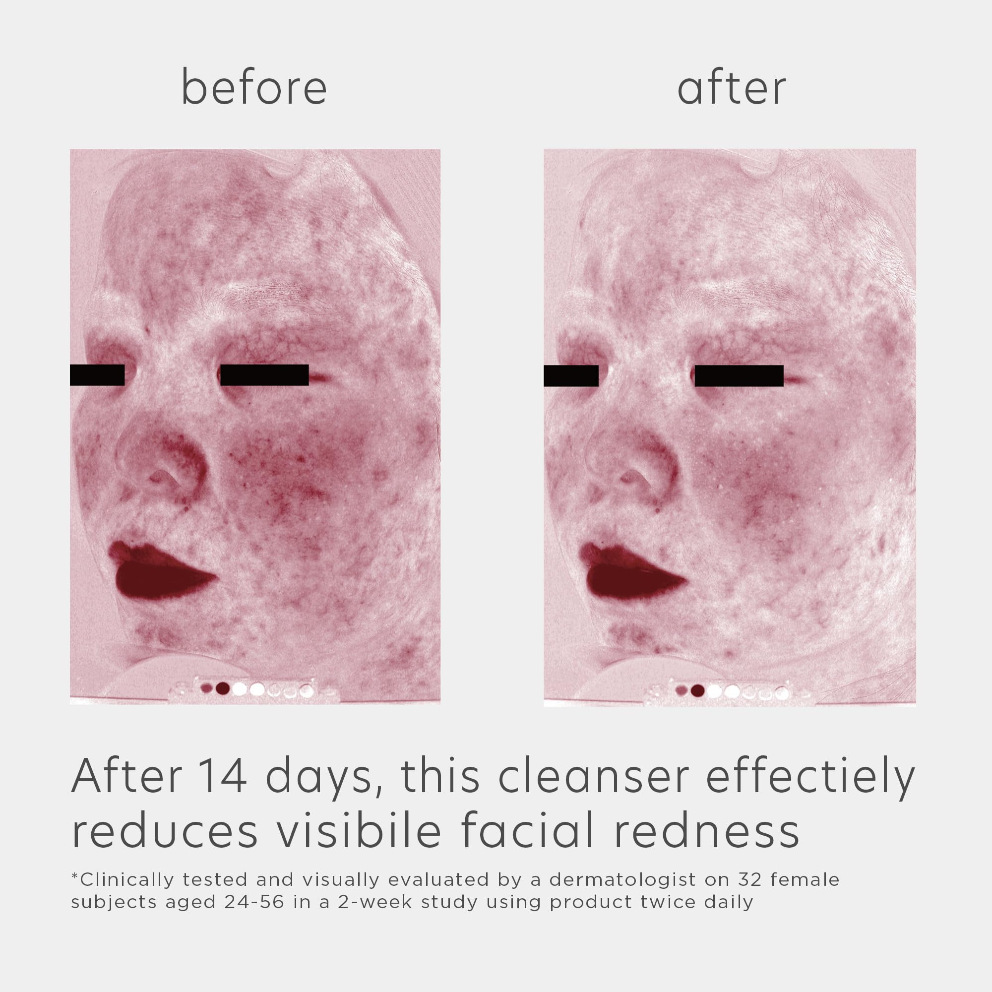 EltaMD travel-size 1oz bottle ideal for on-the-go skincare regimen.