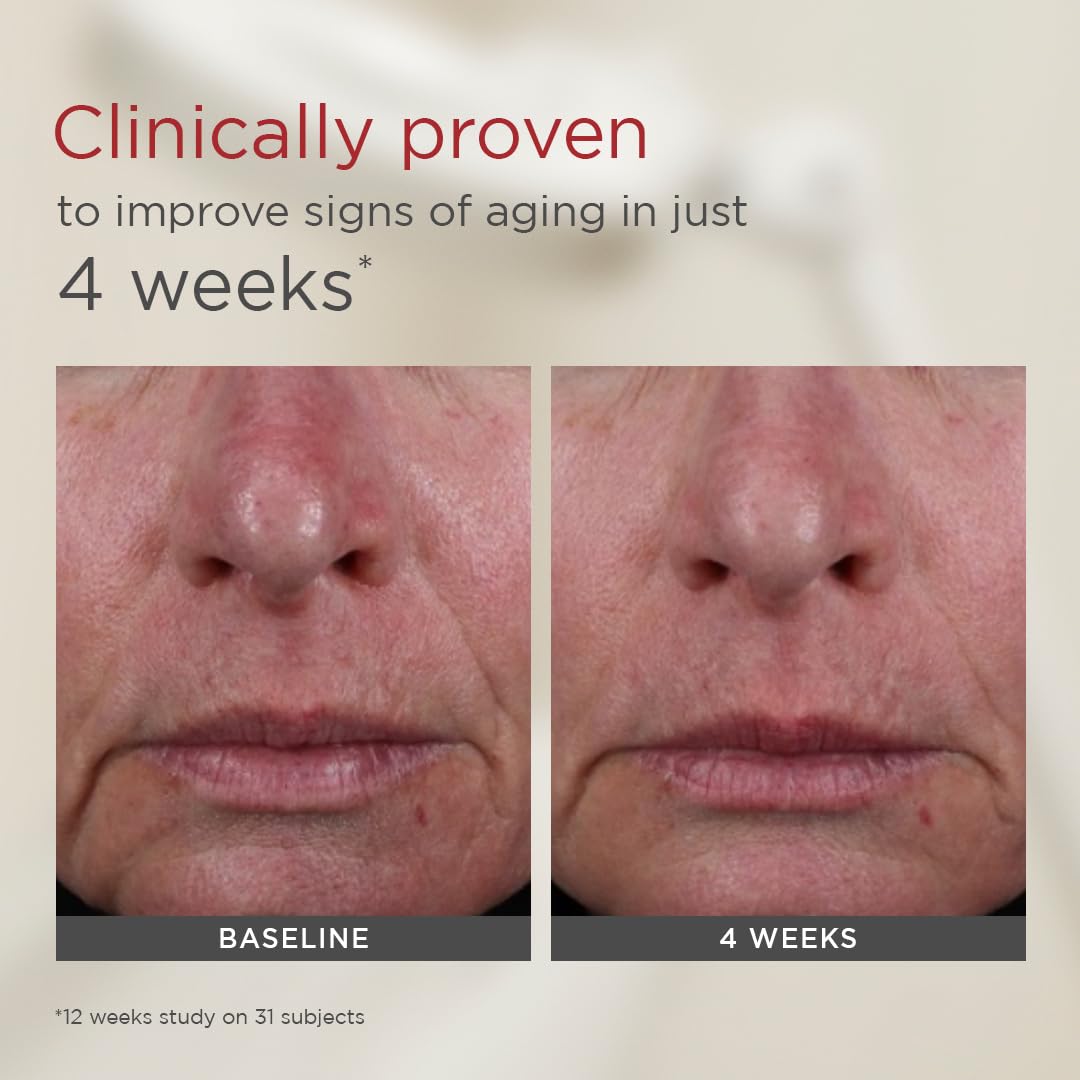 EltaMD UV AOX Elements sensitive-skin friendly daily sunscreen on skin.