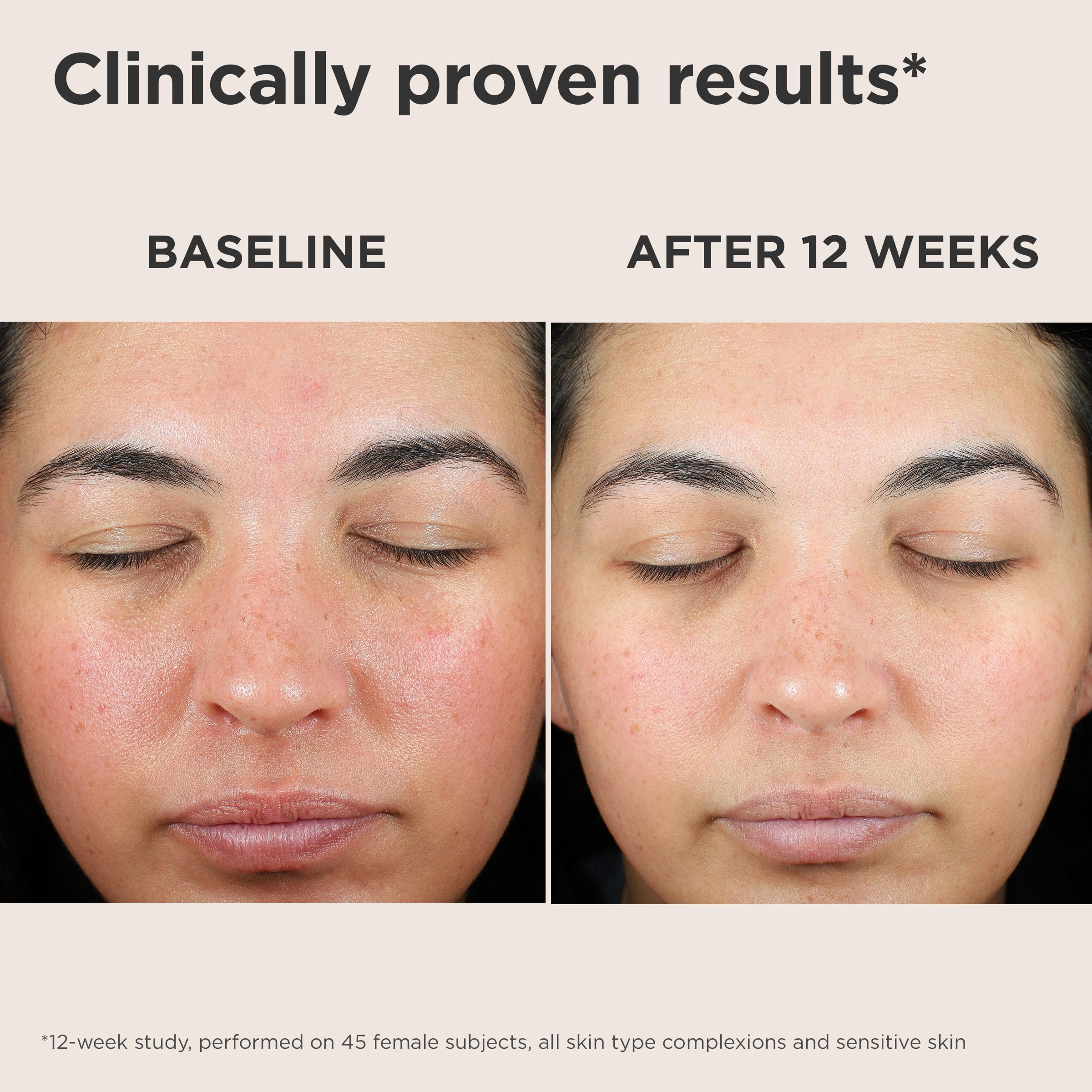 Eltamd UV Skin Recovery routine image suggests morning skincare ritual
