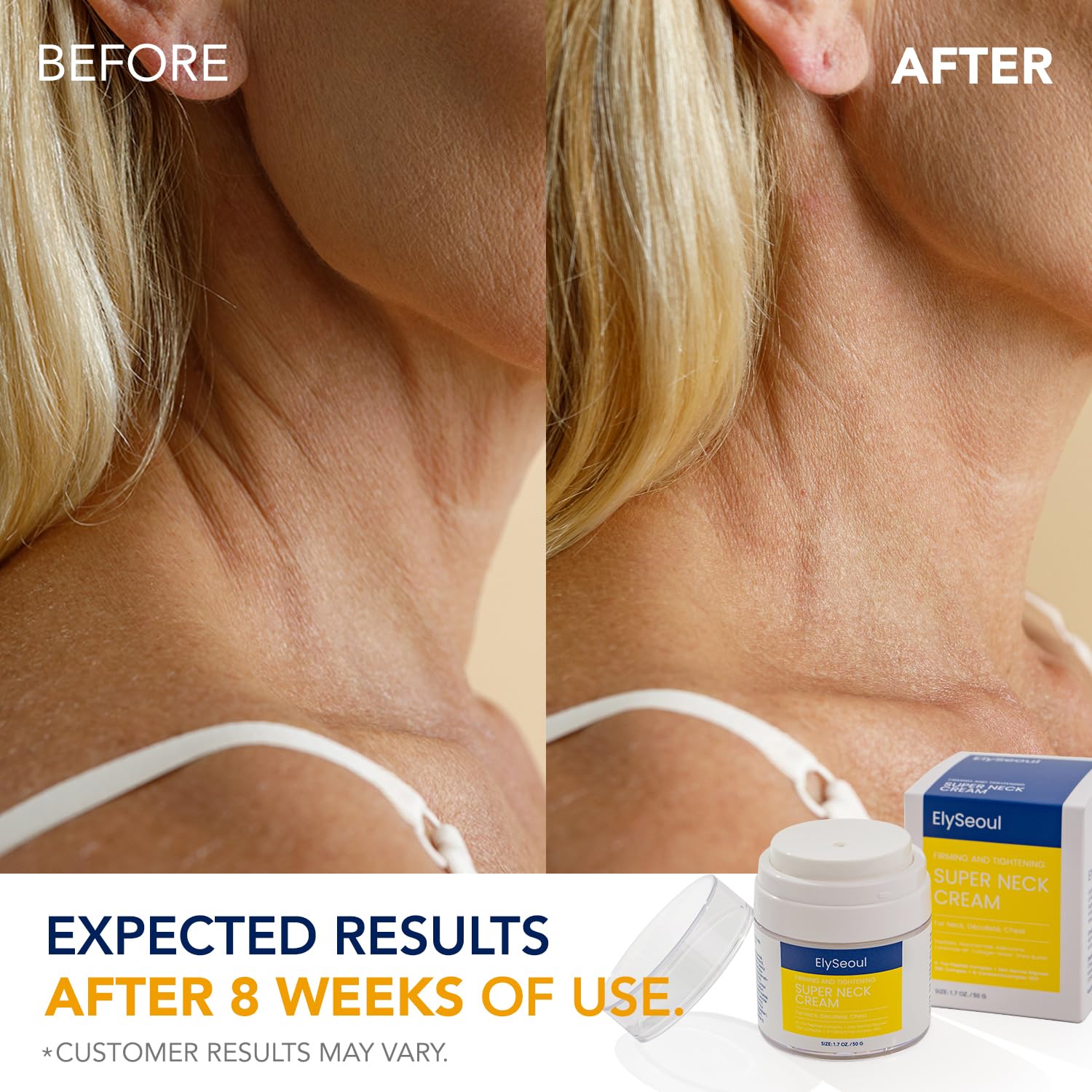 ElySeoul neck cream fine lines closeup hints at texture refinement.
