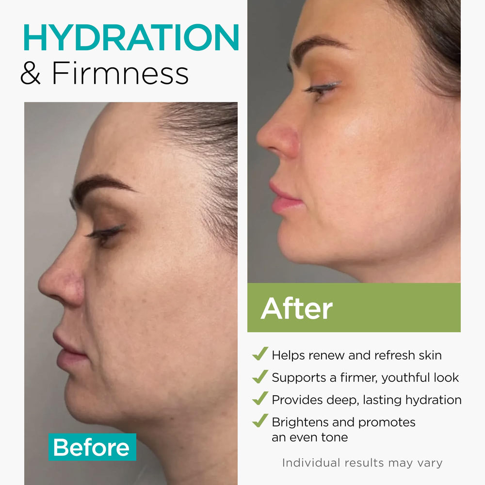 Ember Cloud Collagen NAD+ Cream tube portrait for elasticity routine.