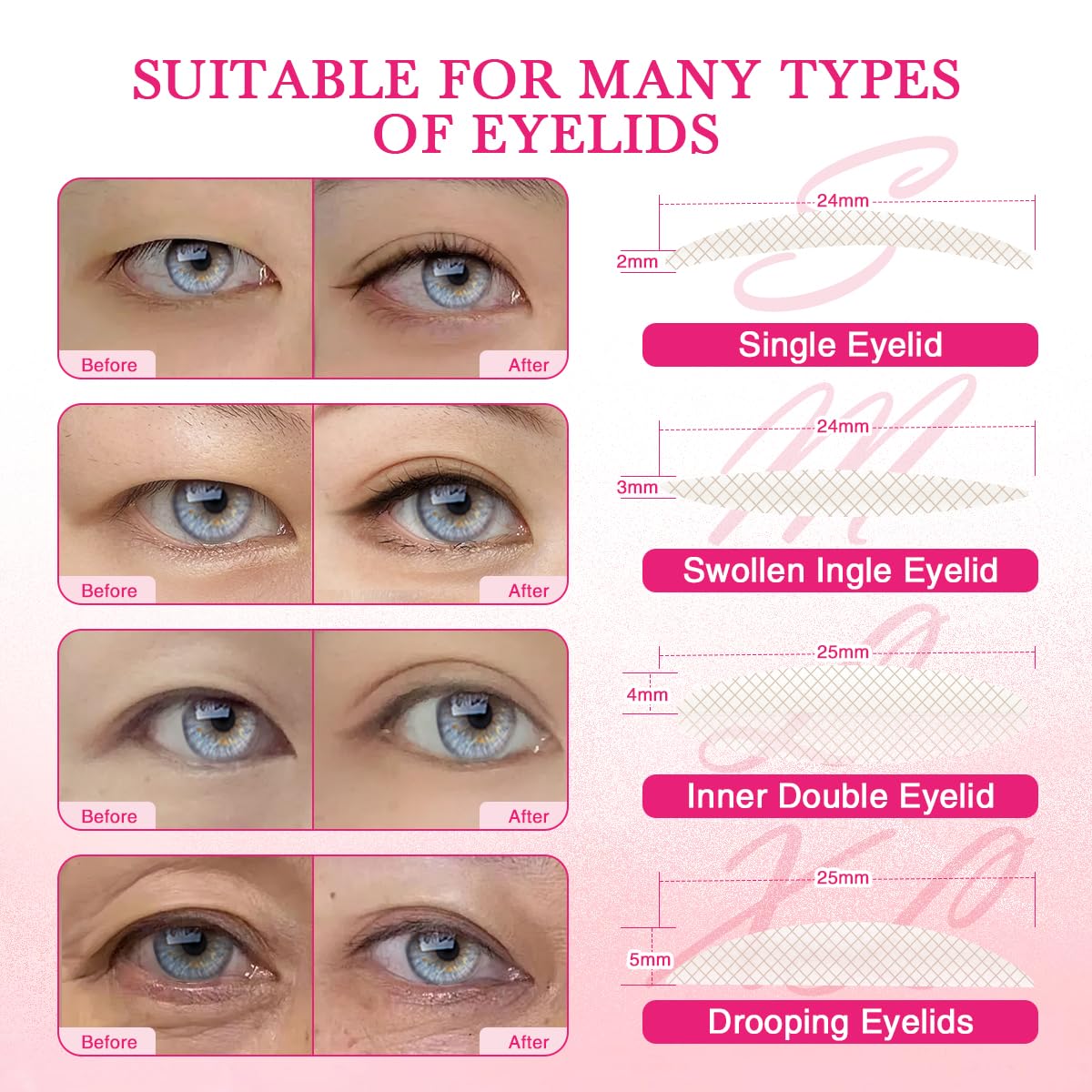 EMEDA application tools with tweezers and shaping liquid enable precise, easy placement.