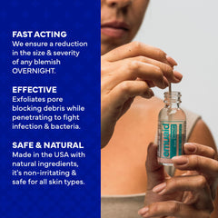 EMUAID overnight acne treatment creamy texture on skin supports overnight clarity