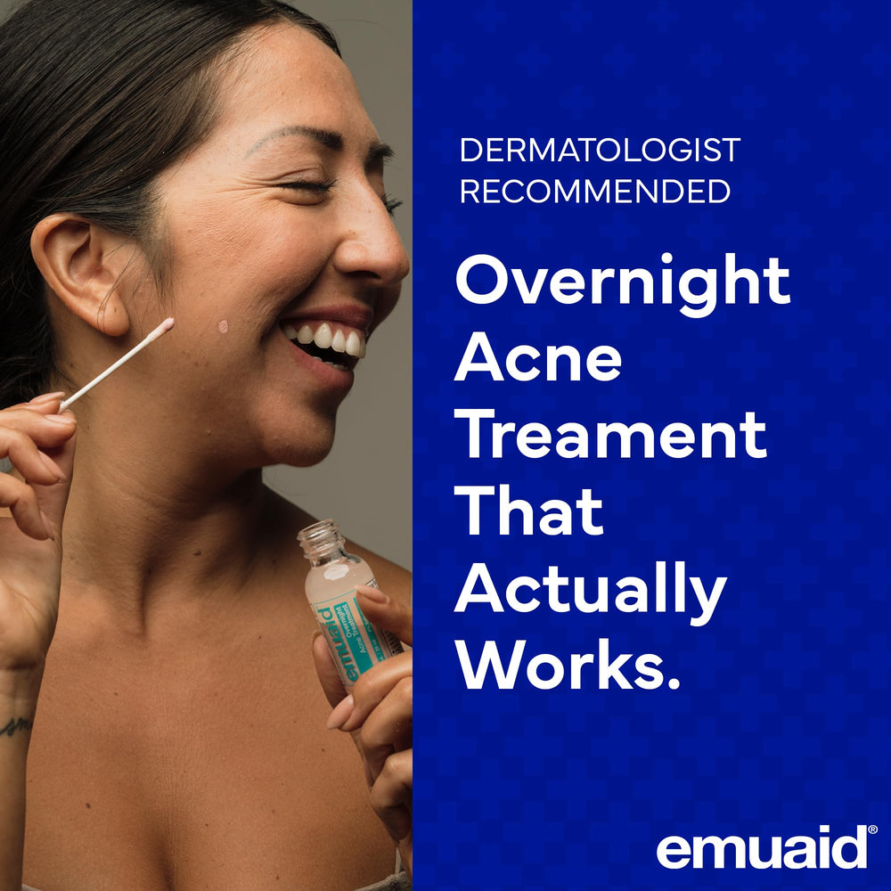 EMUAID overnight acne treatment dab at night for targeted blemish calming