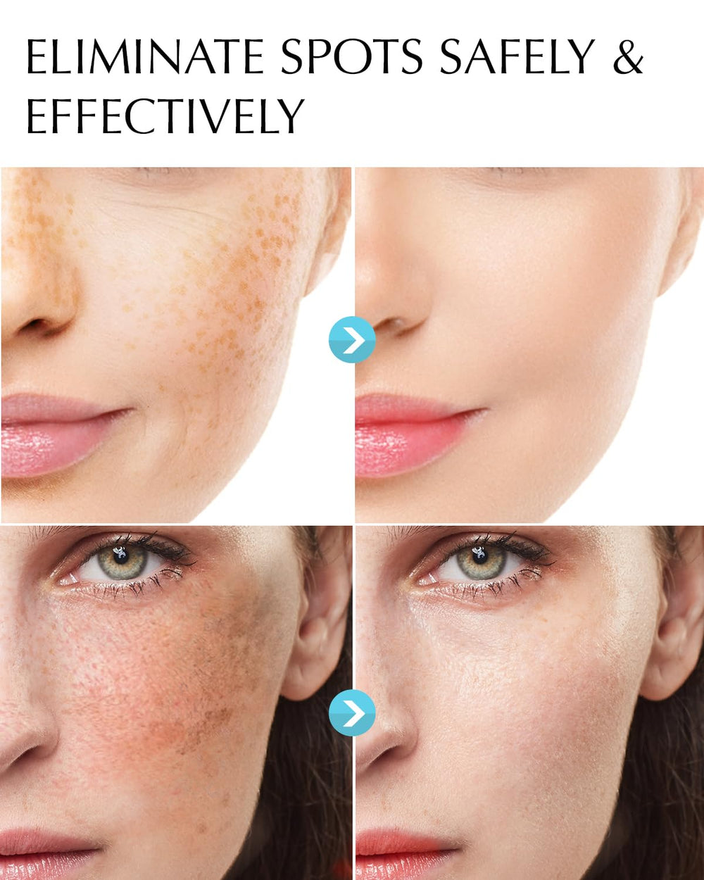 EnaSkin dark spot remover application closeup shows comfortable massage to target freckles and sun spots.