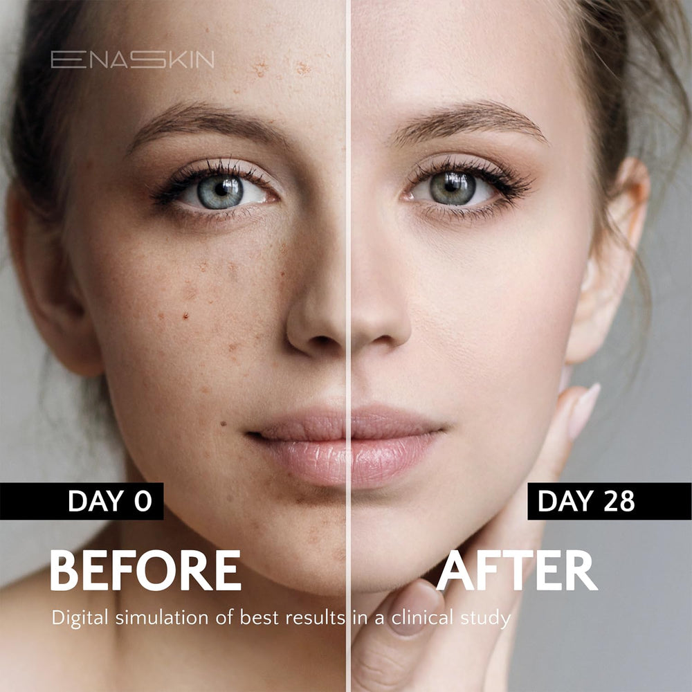 EnaSkin Dark Spot Serum applied to the face for even tone