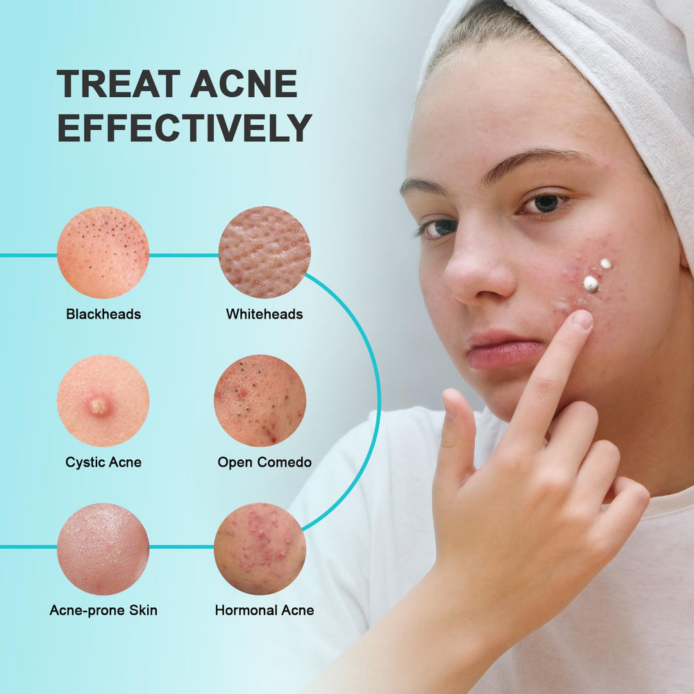 Enaskin Naturals acne spot-treatment tube closeup emphasizes 2% salicylic acid for pore unclogging.