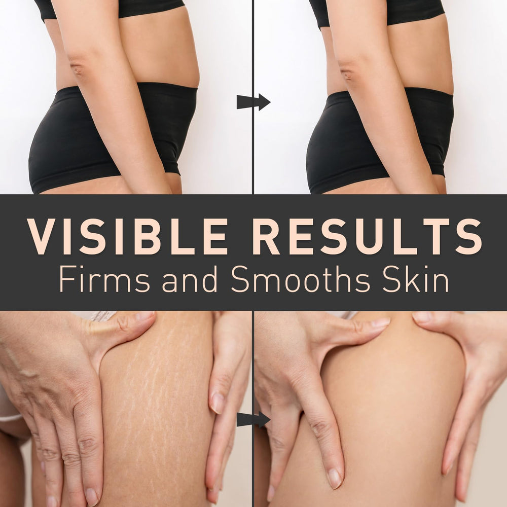 Enaskin Naturals Belly Firming Cream caffeine-based tightening cue