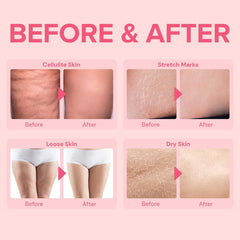 Enaskin Naturals cellulite remover stomach belly lotion shows smoothing around midsection