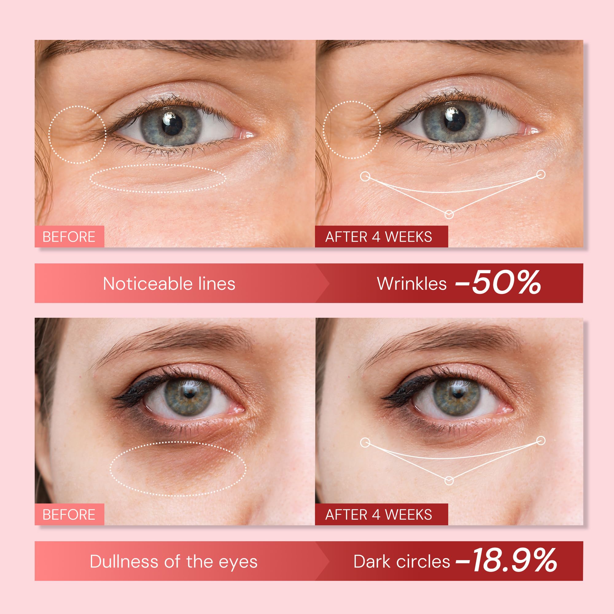 Enaskin Naturals EnaSkin eye cream ceramic massage head provides cooling puffiness relief