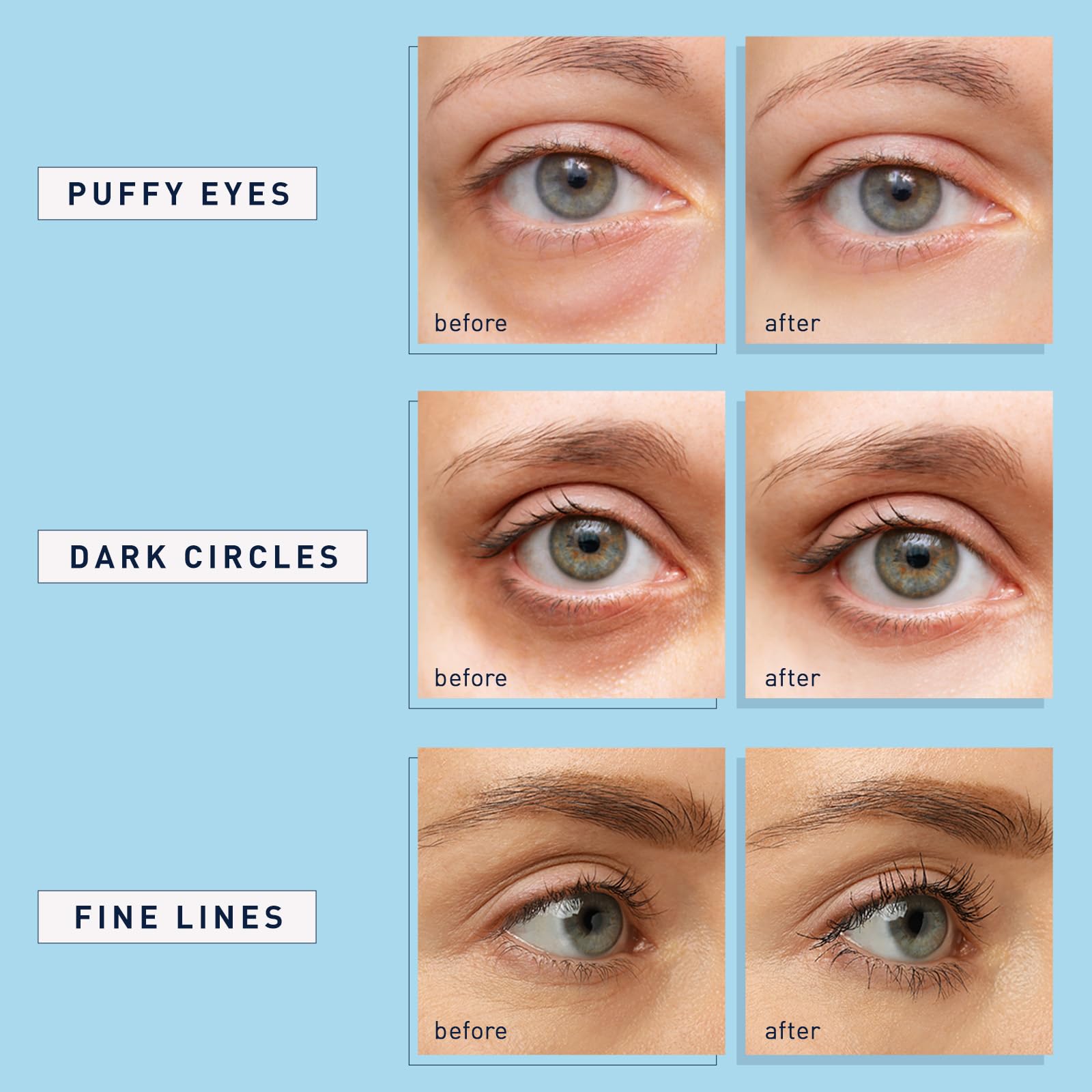 Enaskin Naturals eye patches application view highlighting gentle adhesion suitable for all skin types.