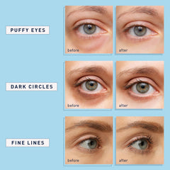 Enaskin Naturals eye patches application view highlighting gentle adhesion suitable for all skin types.