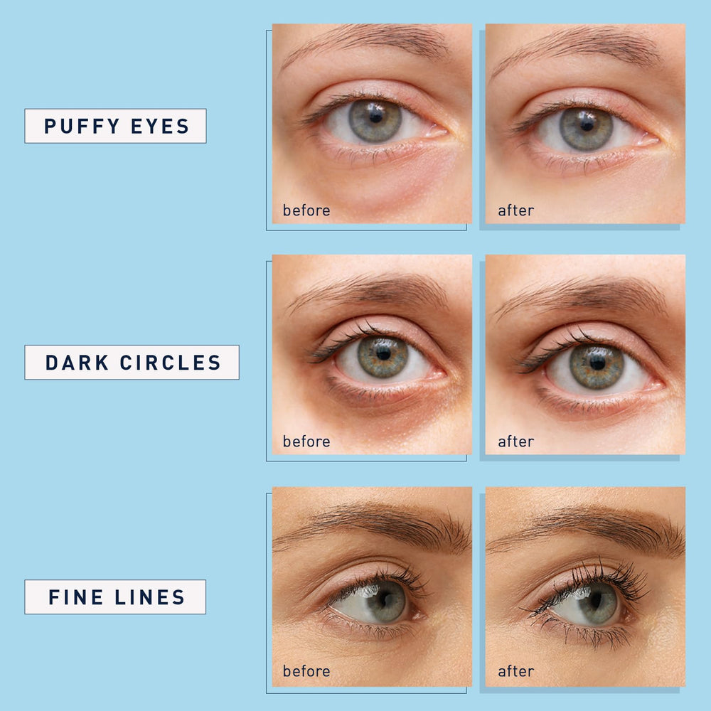 Aplicación fácil de 20 minutos para ojos con Enaskin Naturals