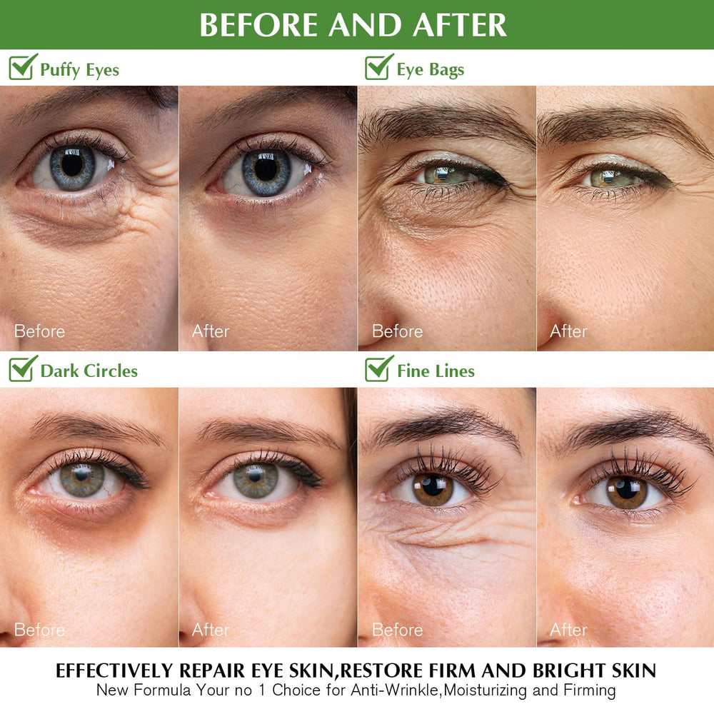 Enaskin Naturals under-eye patches closeup with smooth hydrogel surface for comfortable wear.