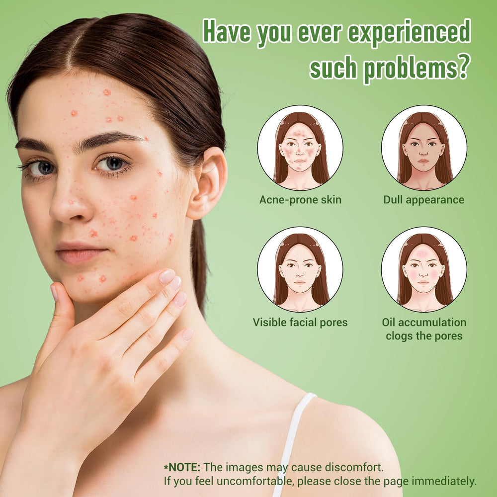 Eofot azelaic acid cream tube for smooth, consistent application.