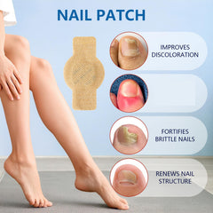 EOIRULA Toenail Patch on toe nail at bedtime supports smoother appearance