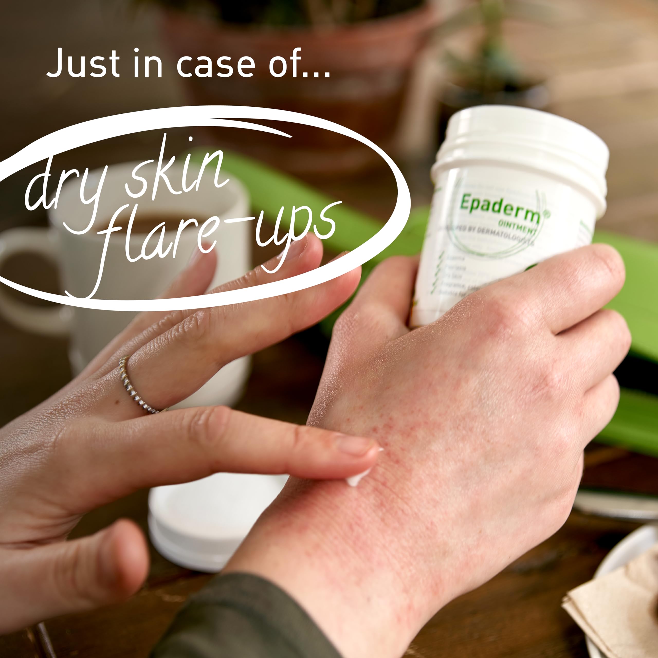 Epaderm 125g compact packaging sits ready for on-the-go moisturising.