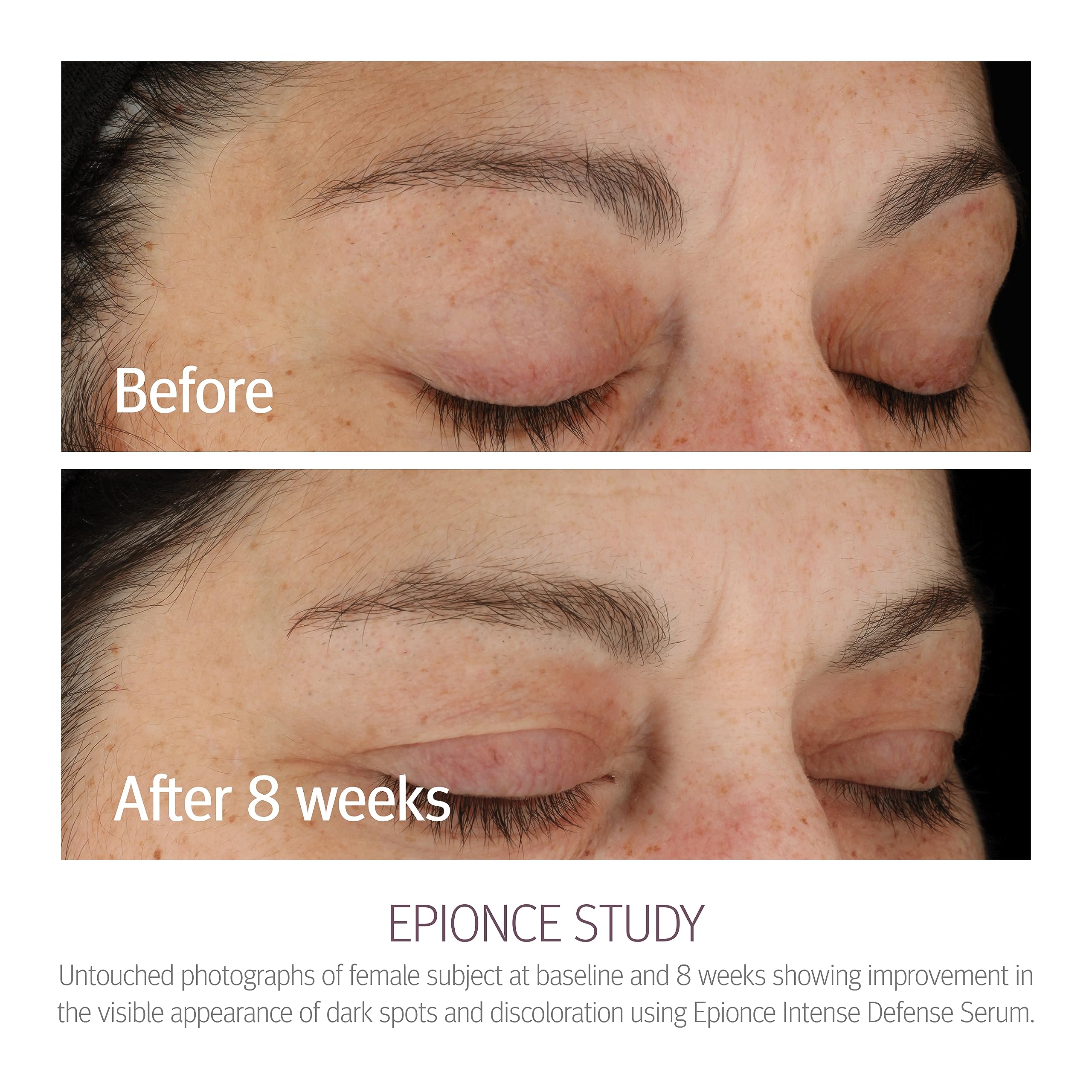 Epionce Intense Defense Serum vitamin chart highlights botanical vitamins for skin nutrition.