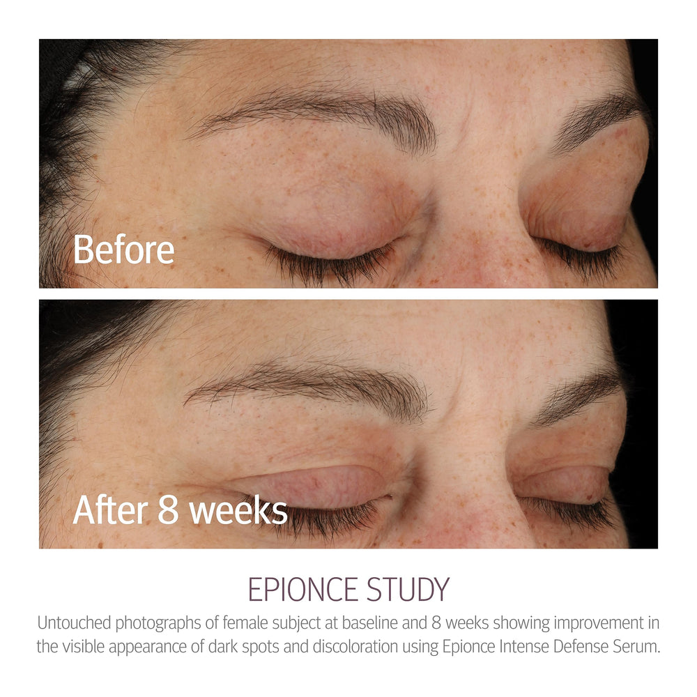 Epionce Intense Defense Serum vitamin chart highlights botanical vitamins for skin nutrition.