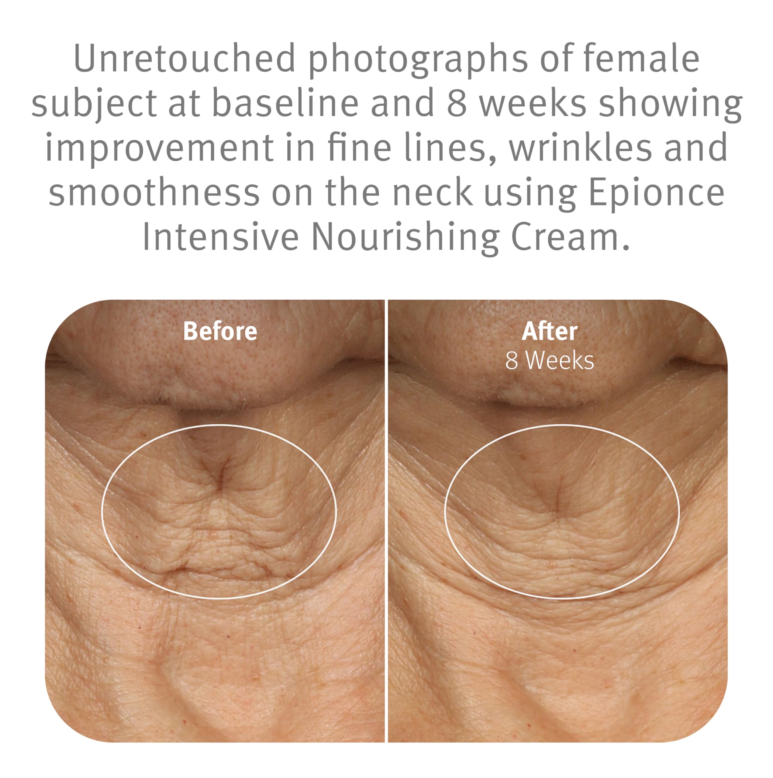Epionce Intensive Nourishing Cream ceramides visual highlights barrier-supporting formula.