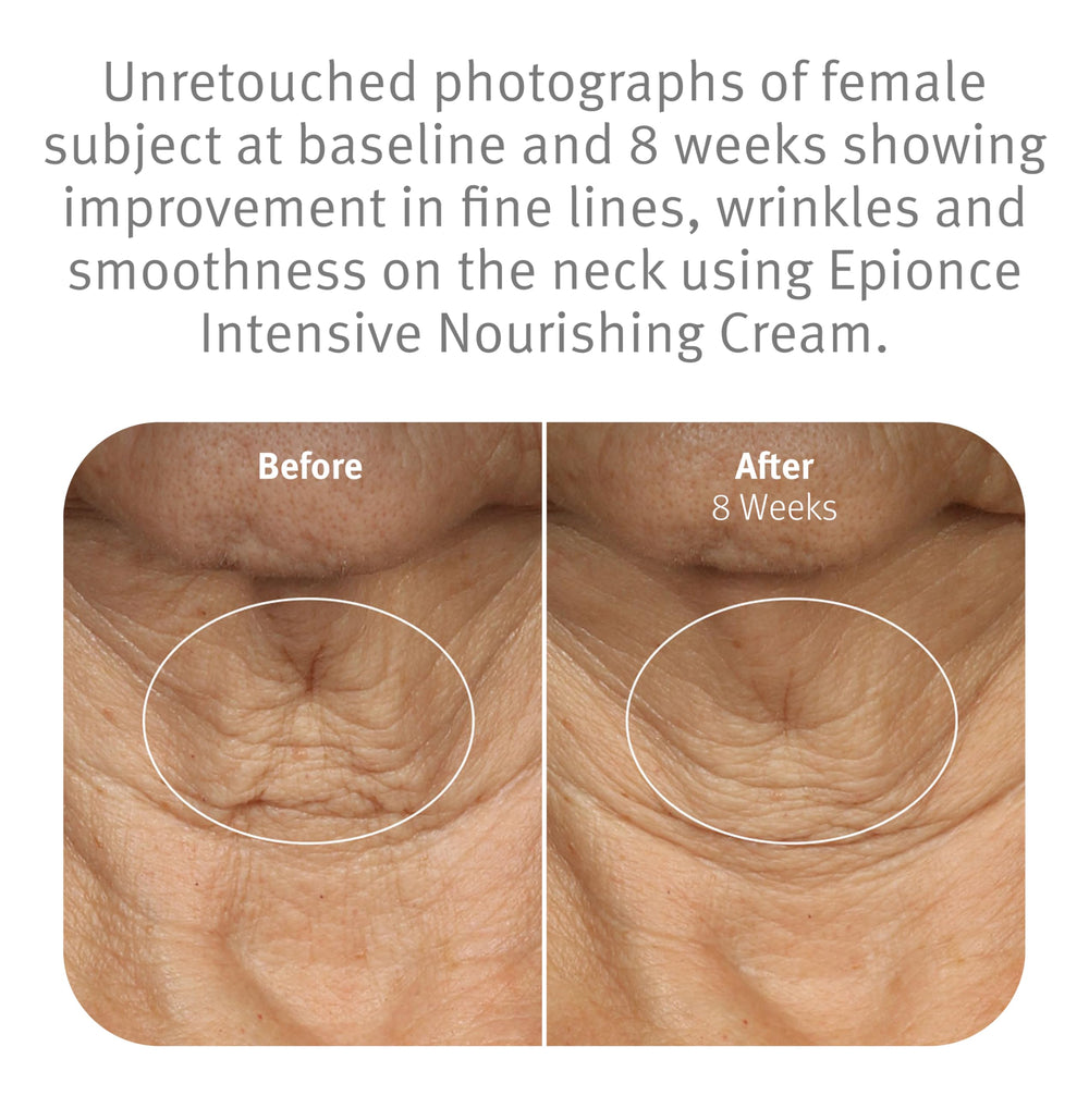 Epionce Intensive Nourishing Cream ceramides visual highlights barrier-supporting formula.