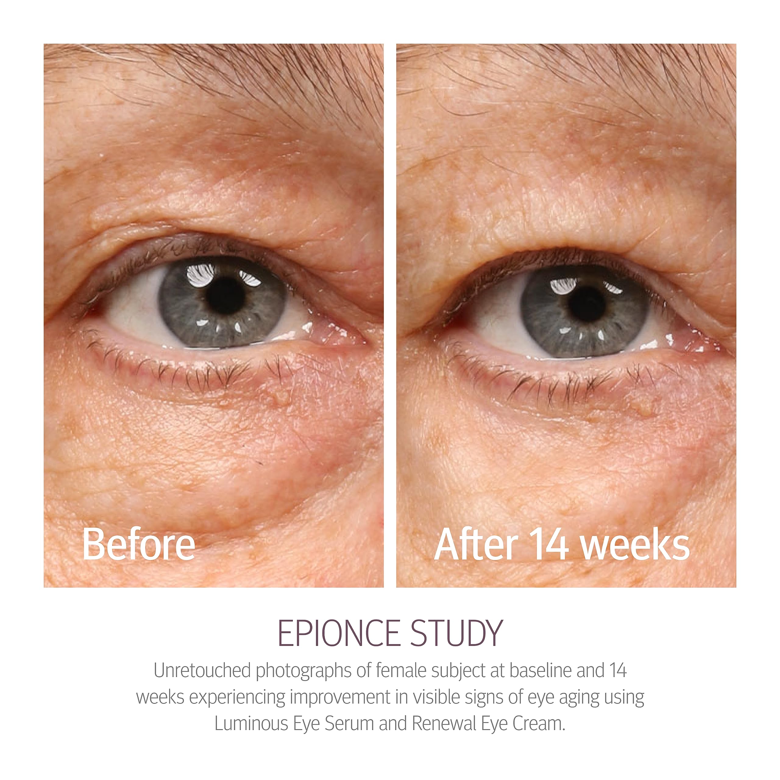 Epionce Renewal Eye Cream soft-focus effect diffusing light on dark circles.