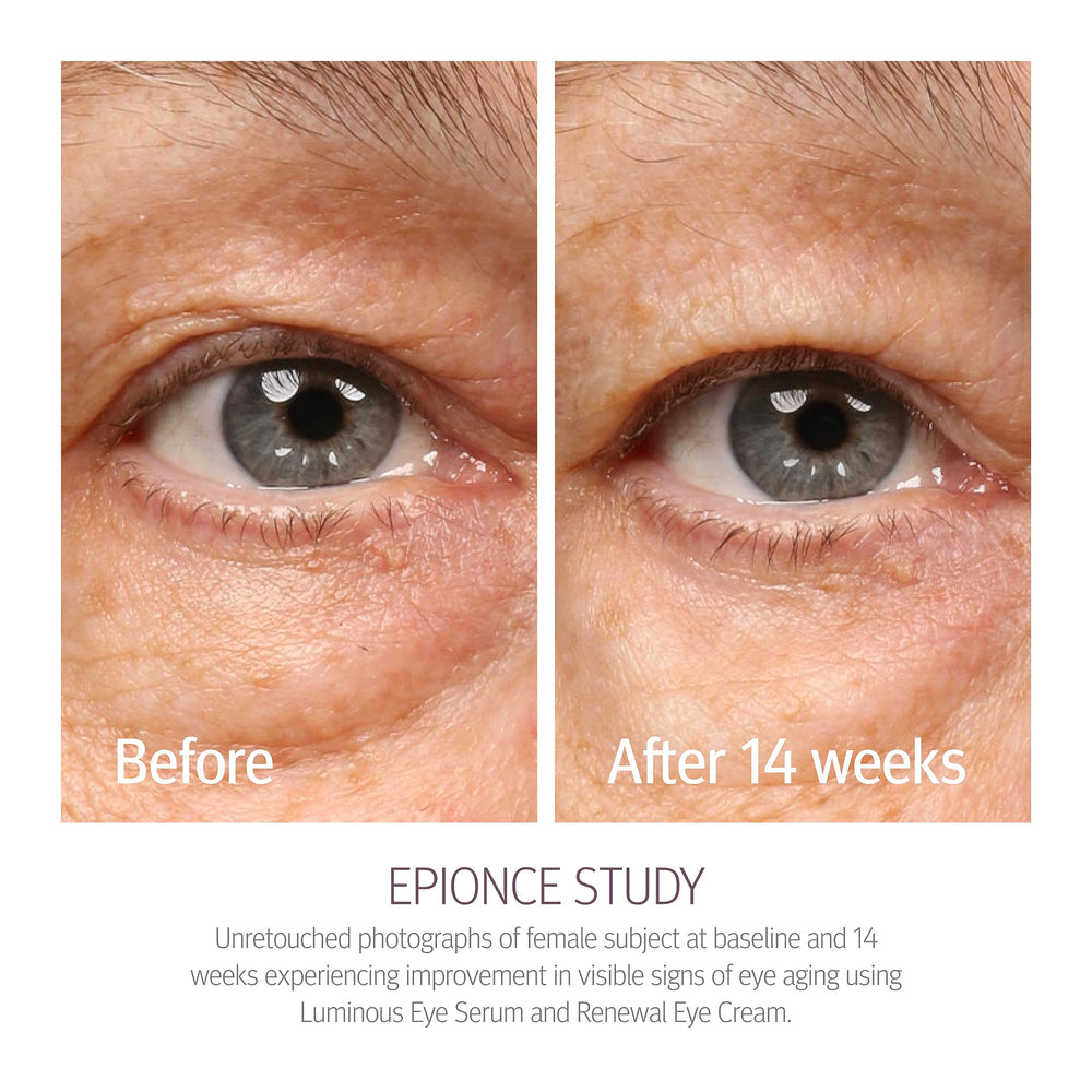 Epionce Renewal Eye Cream soft-focus effect diffusing light on dark circles.