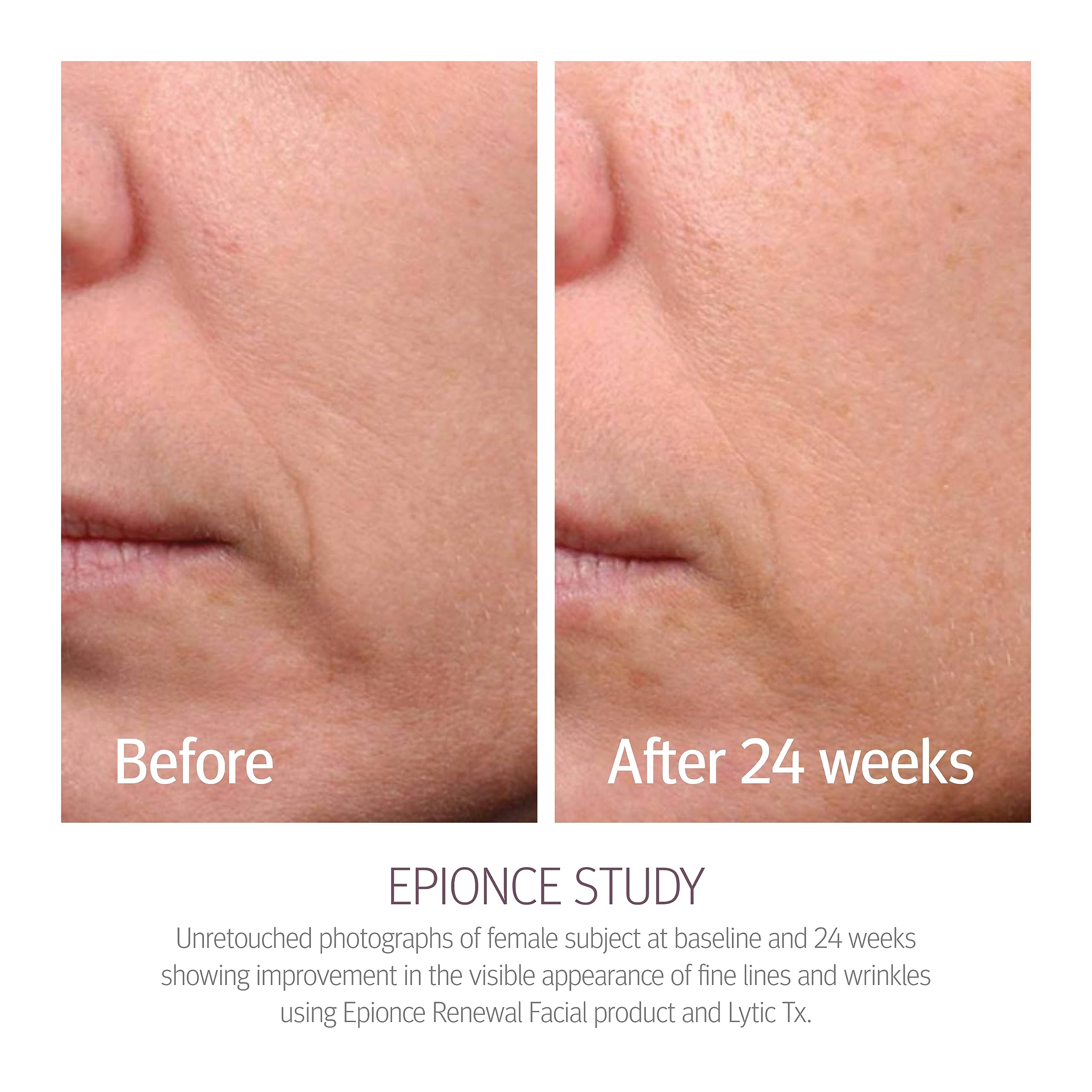 Epionce Renewal Facial Lotion swirl on hand conveys smooth, non-greasy finish