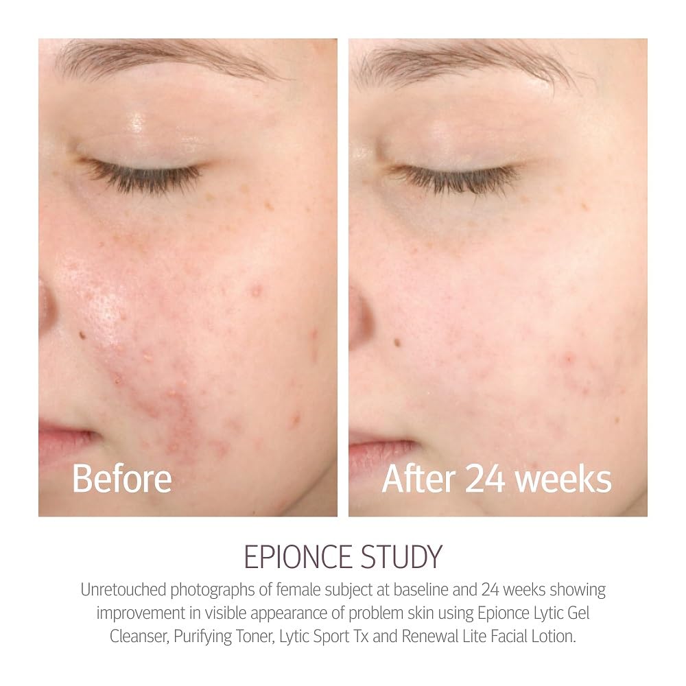Epionce Renewal Lite Facial Lotion pump in use during morning routine.