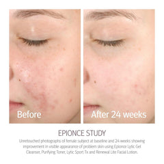Epionce Renewal Lite Facial Lotion pump in use during morning routine.
