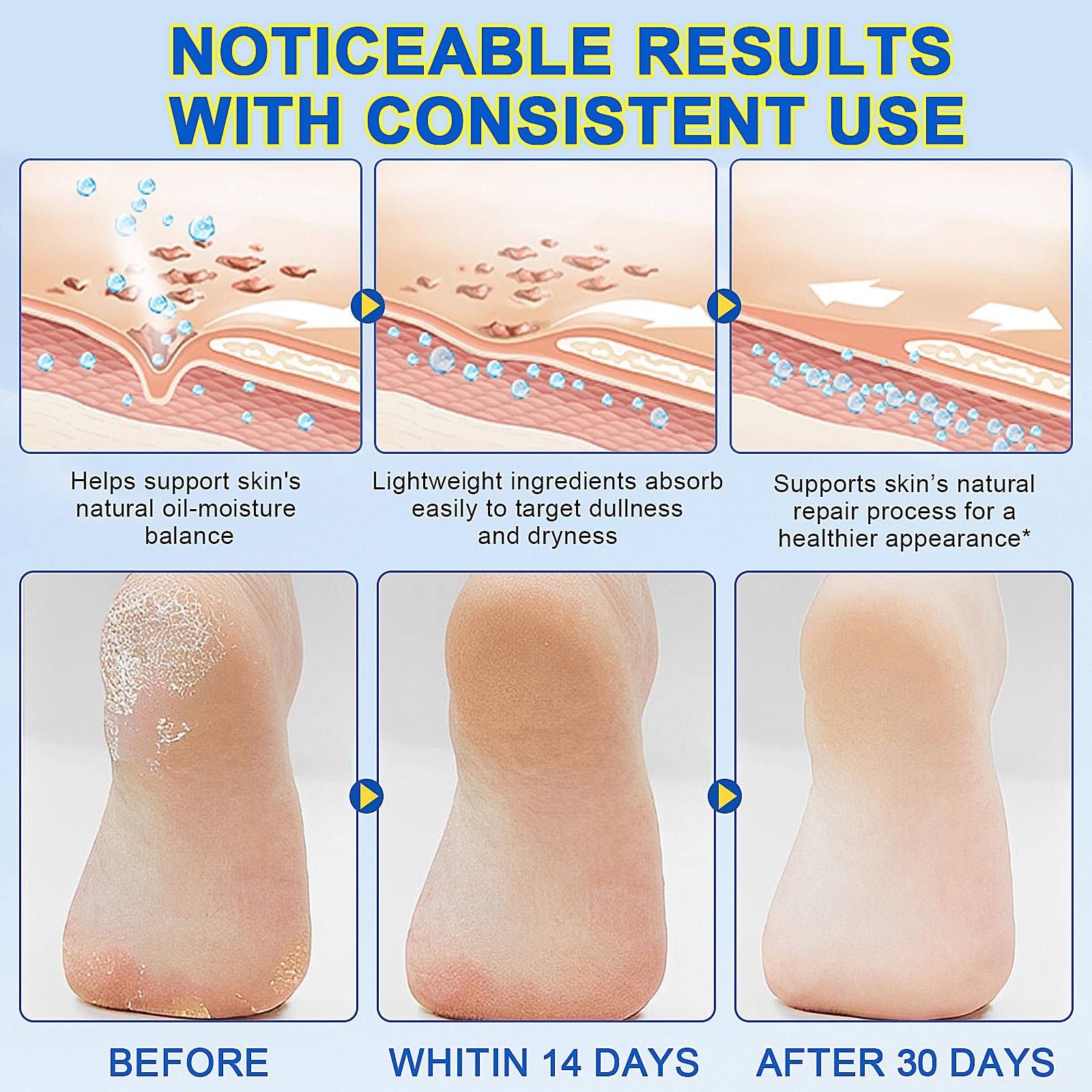 Eqimznv 60% Urea Stick elbows knees image suggests multi-area dry skin care.