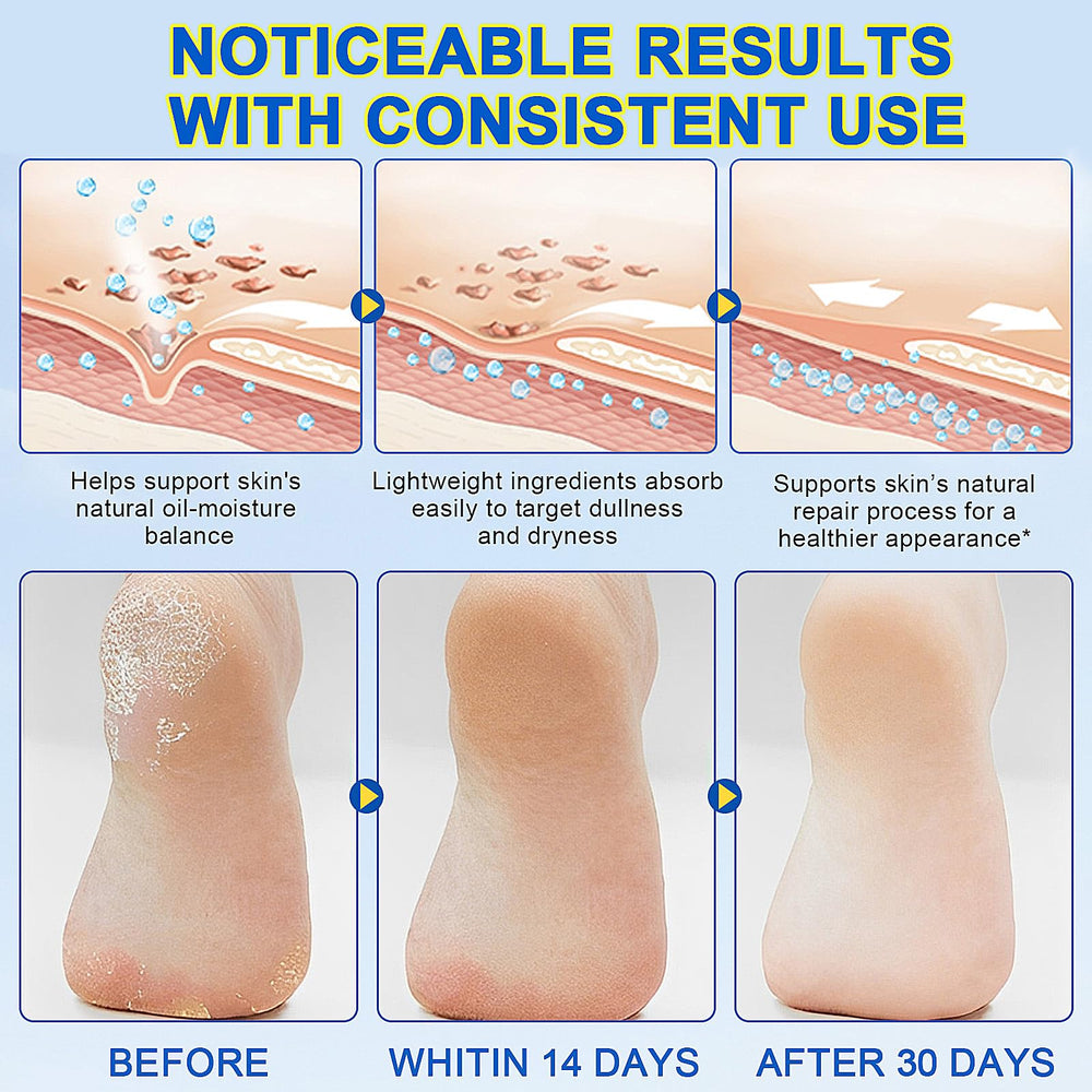 Eqimznv 60% Urea Stick elbows knees image suggests multi-area dry skin care.