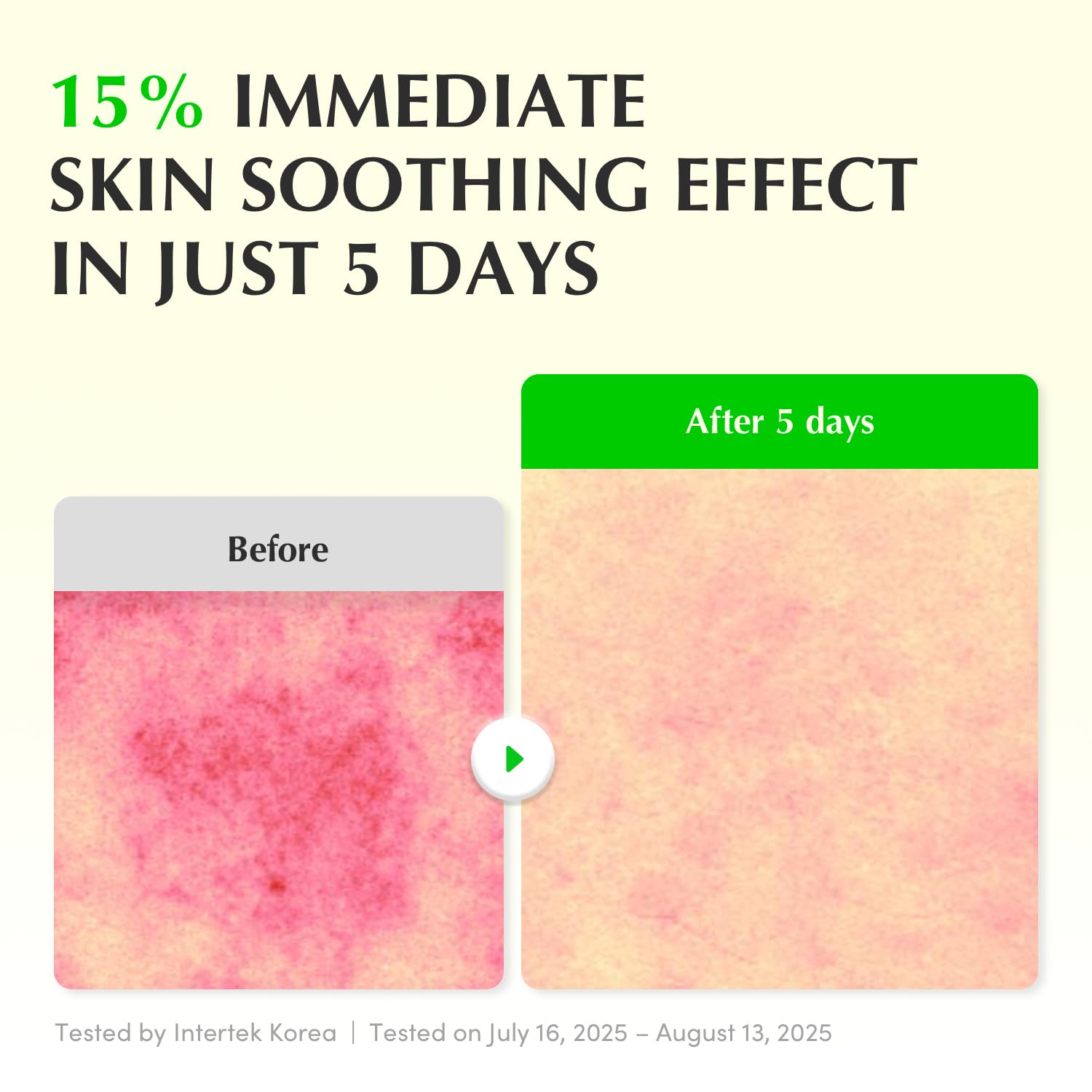 EQQUALBERRY Aloe PDRN close-up ingredients emphasizes Aloe PDRN and calming actives.
