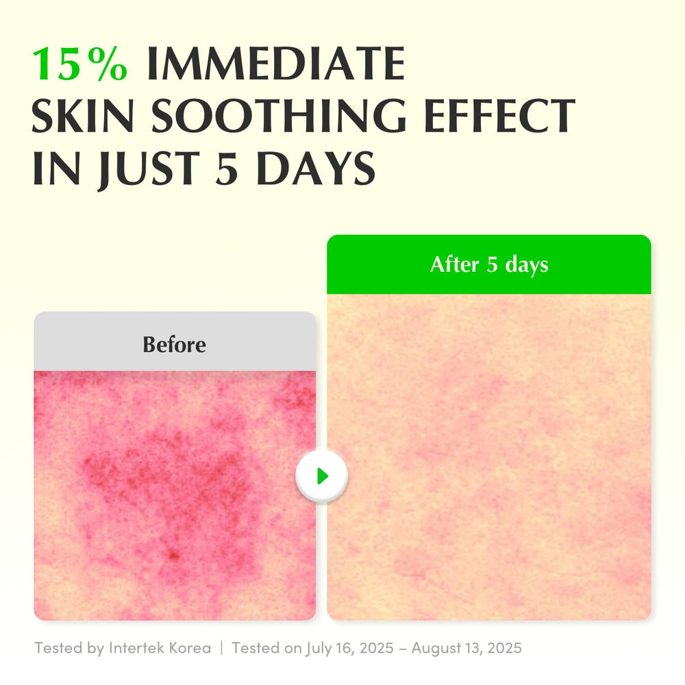 EQQUALBERRY Aloe PDRN close-up ingredients emphasizes Aloe PDRN and calming actives.
