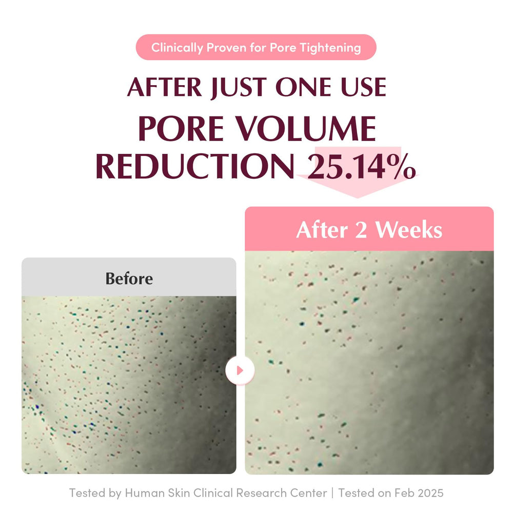 EQQUALBERRY pore-tight mask worn on skin demonstrates pore tightening and refreshed look.