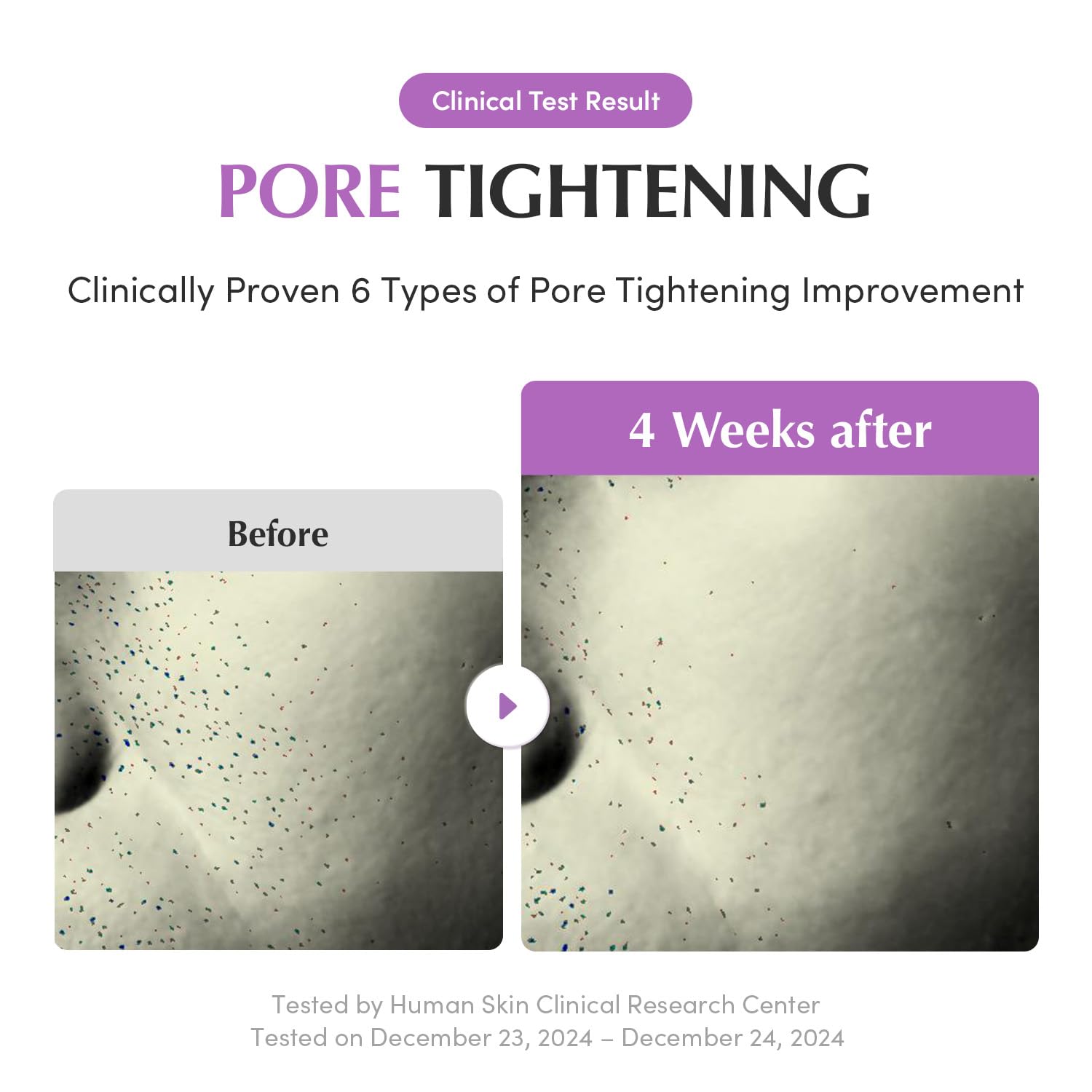 EQQUALBERRY Pore before-after shows elasticity improvement