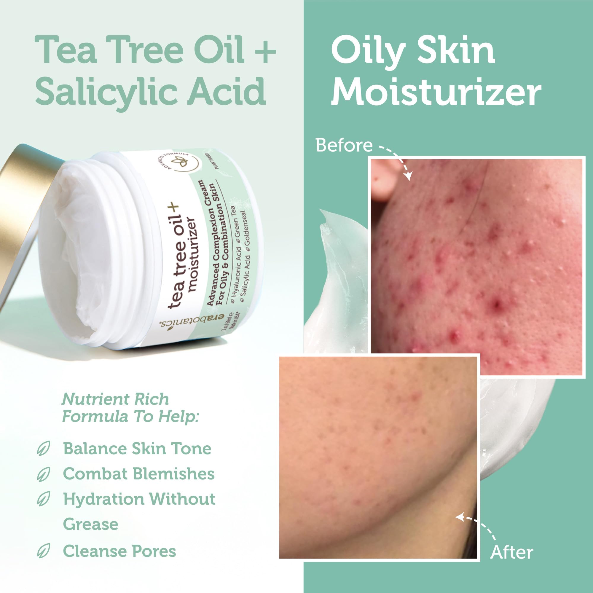 Era Organics Tea Tree Cream on skin for a matte, non-greasy finish
