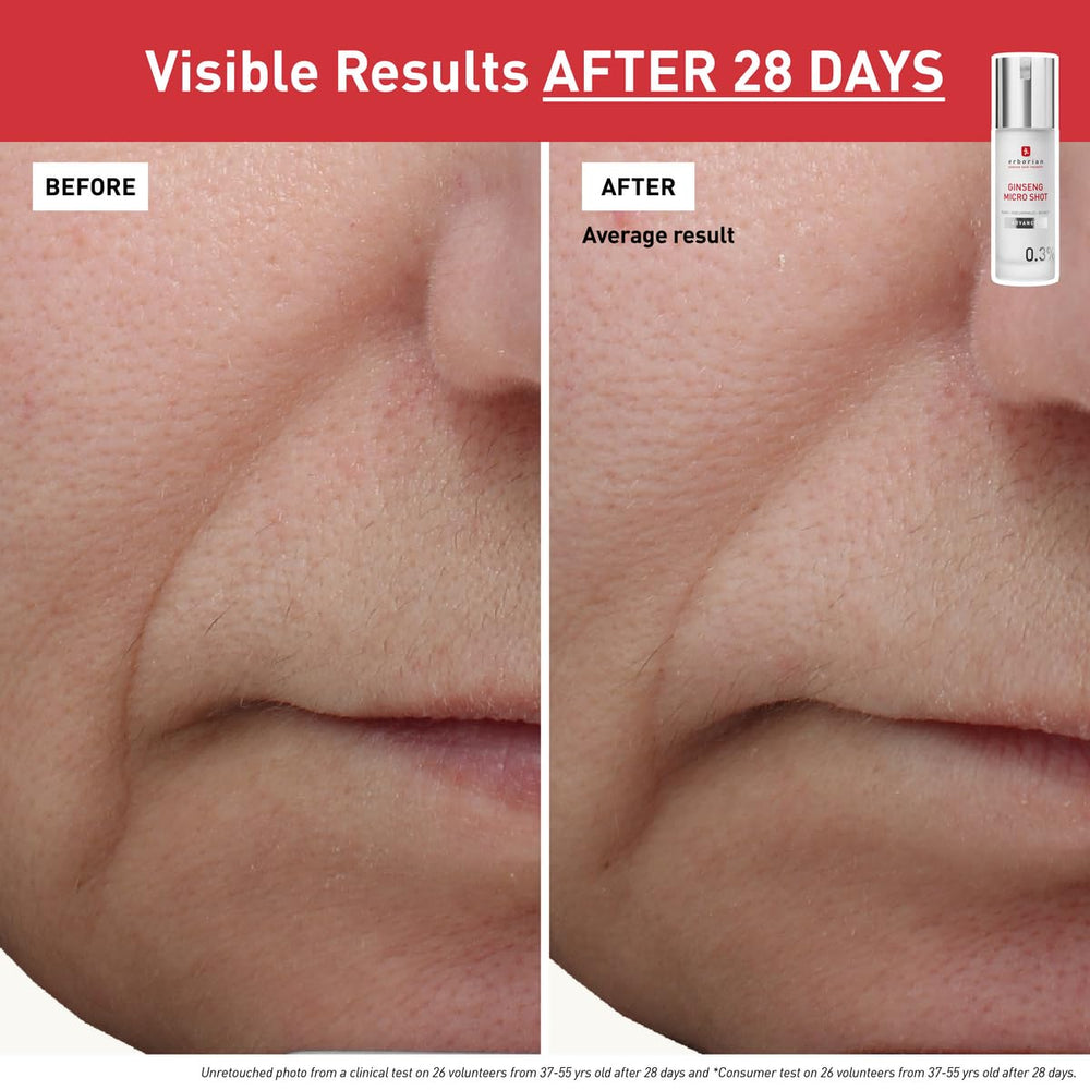 Erborian Ginseng Micro Shot micro-infusion on skin suggests renewal-like surface channels