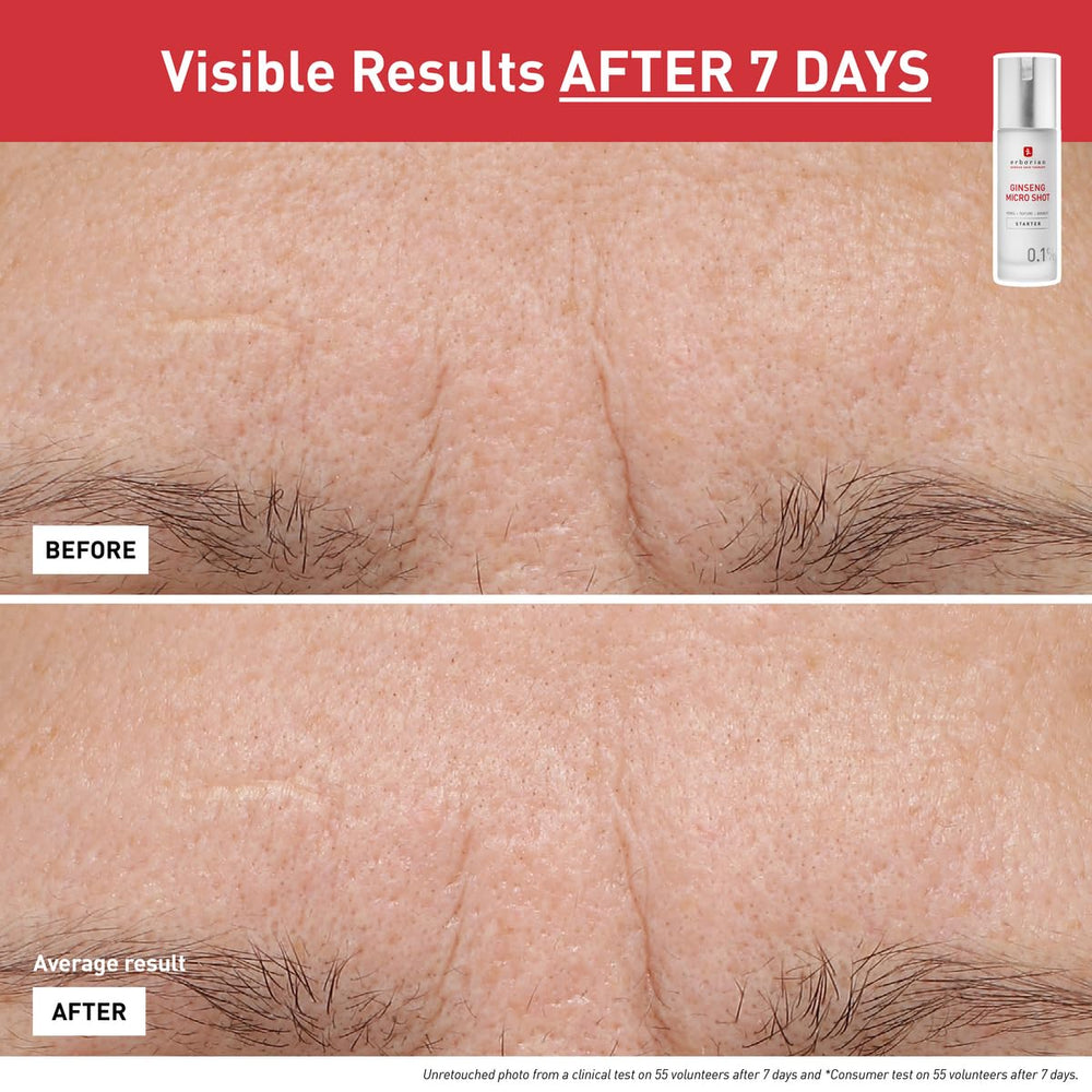 Erborian Ginseng Micro Shot micro-infusion visual hints surface channels for renewal.