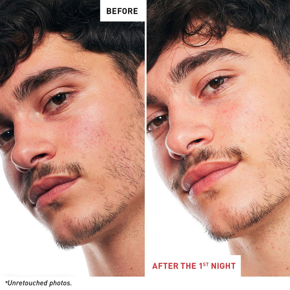 Erborian Skin Therapy application motion implying easy nightly use and fast absorption