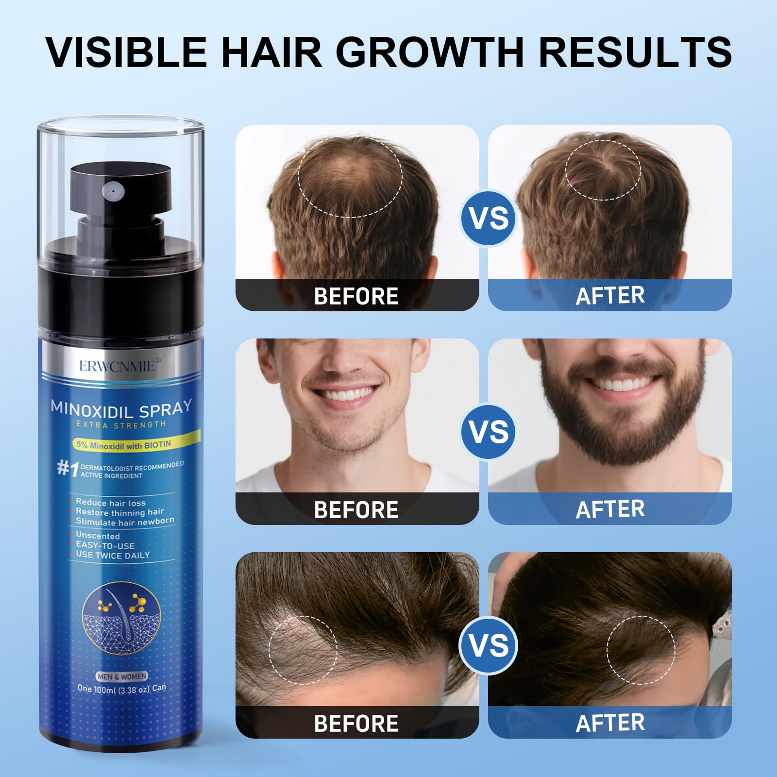 ERWCNMIE derma roller included to boost absorption and scalp stimulation.