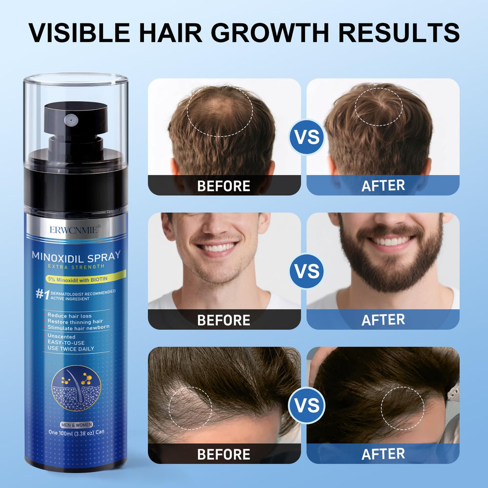 ERWCNMIE derma roller included to boost absorption and scalp stimulation.