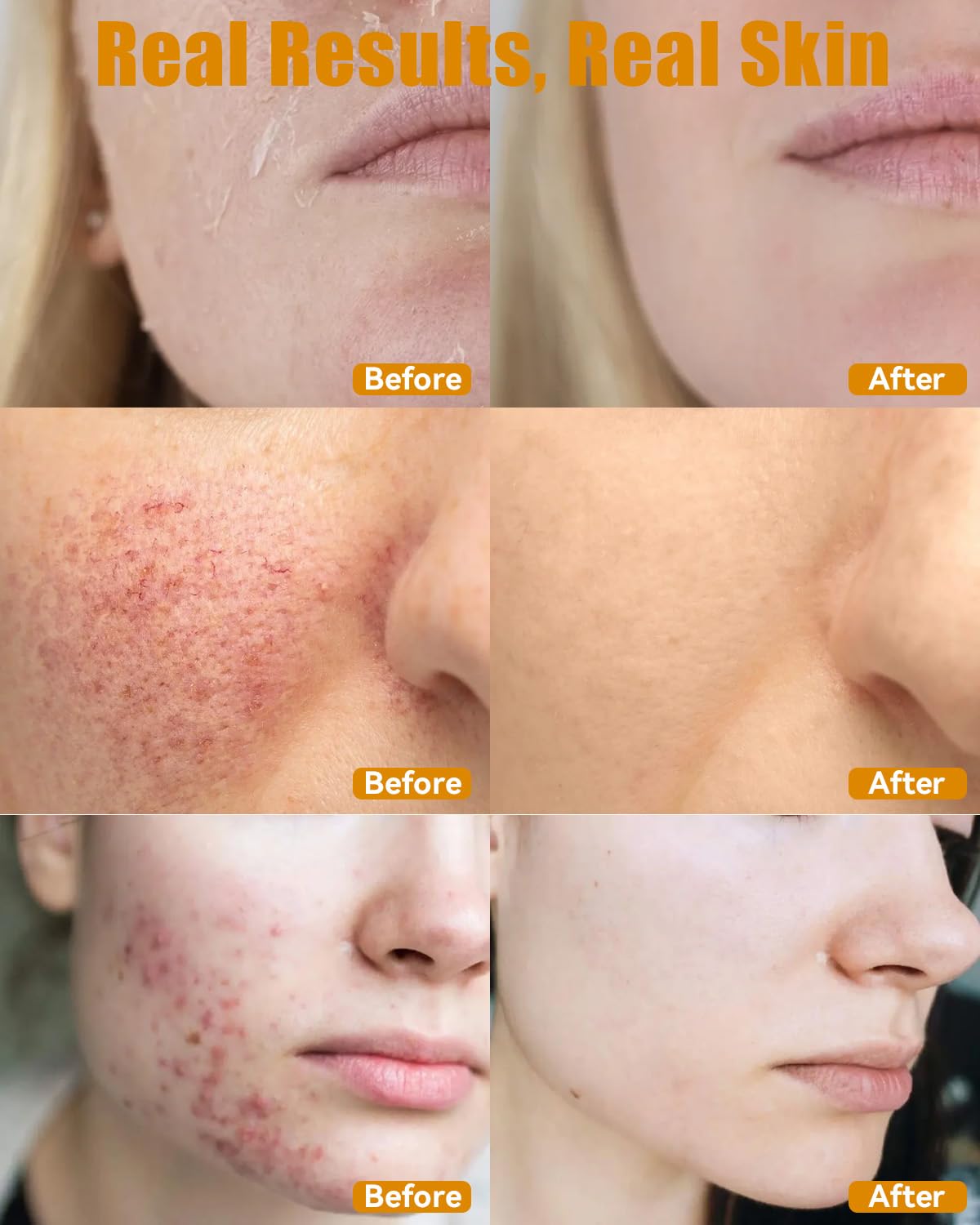 ESAWFVL multi-purpose balm used on face, body, and hands.