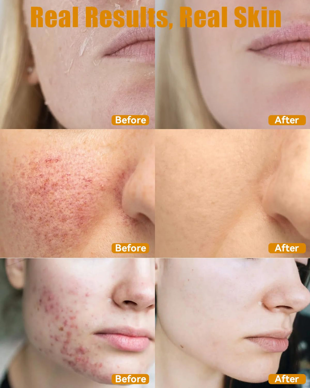 ESAWFVL multi-purpose balm used on face, body, and hands.