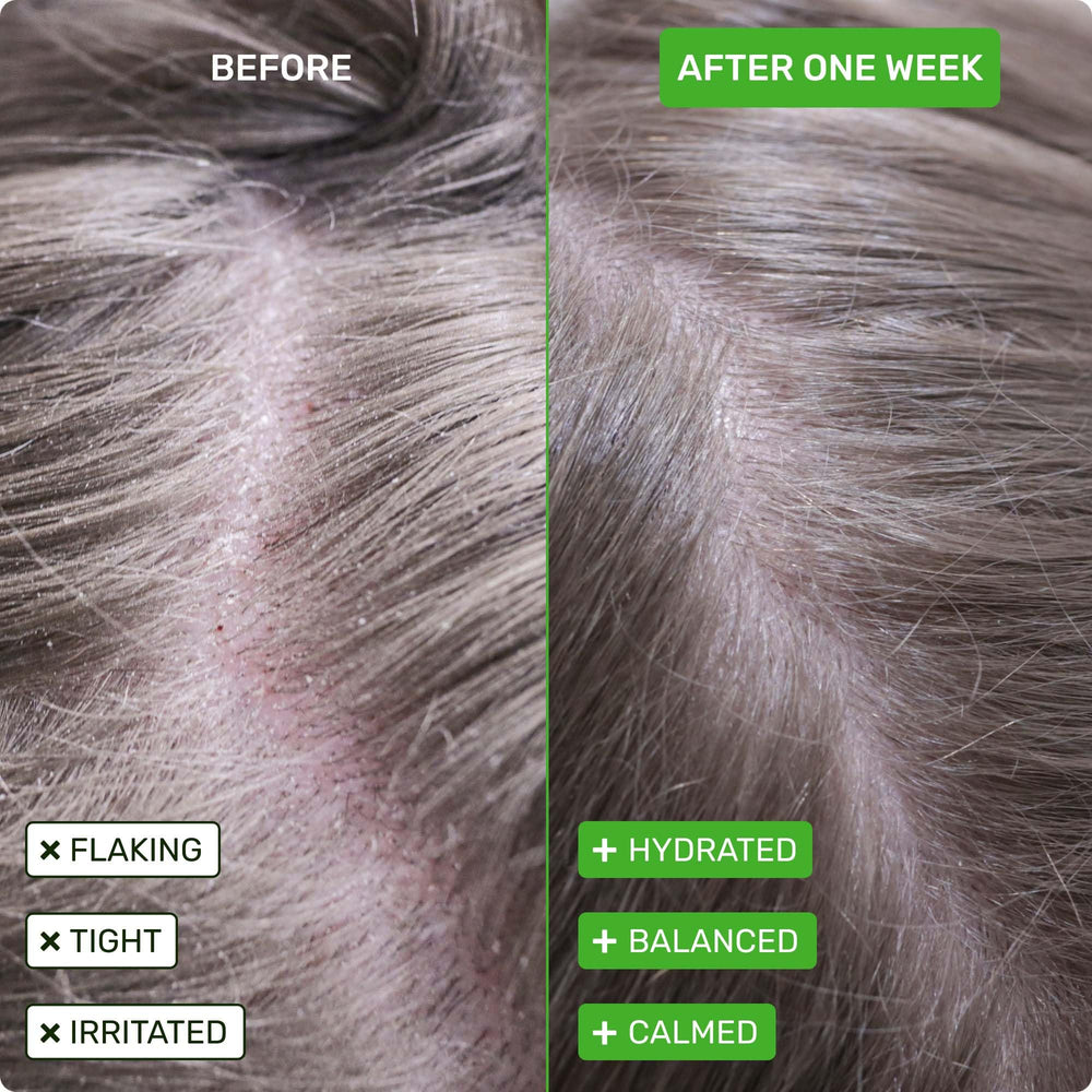 Ethique Scalp Health Shampoo Bar lathering action on hair in a close-up.