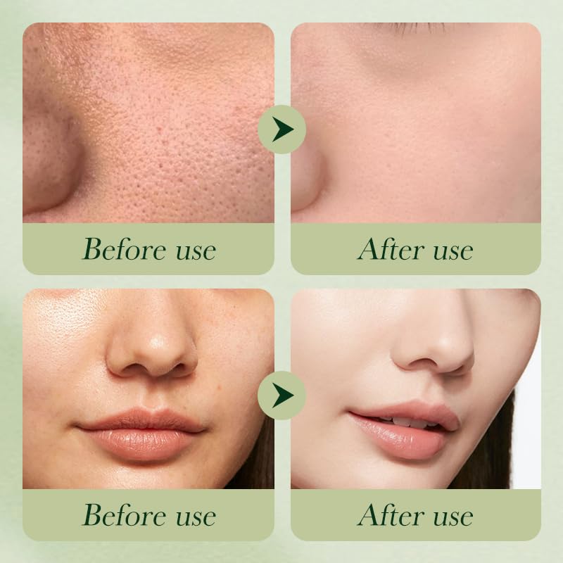 Etuanxi Avocado Toner bottle, refreshing skin prep.