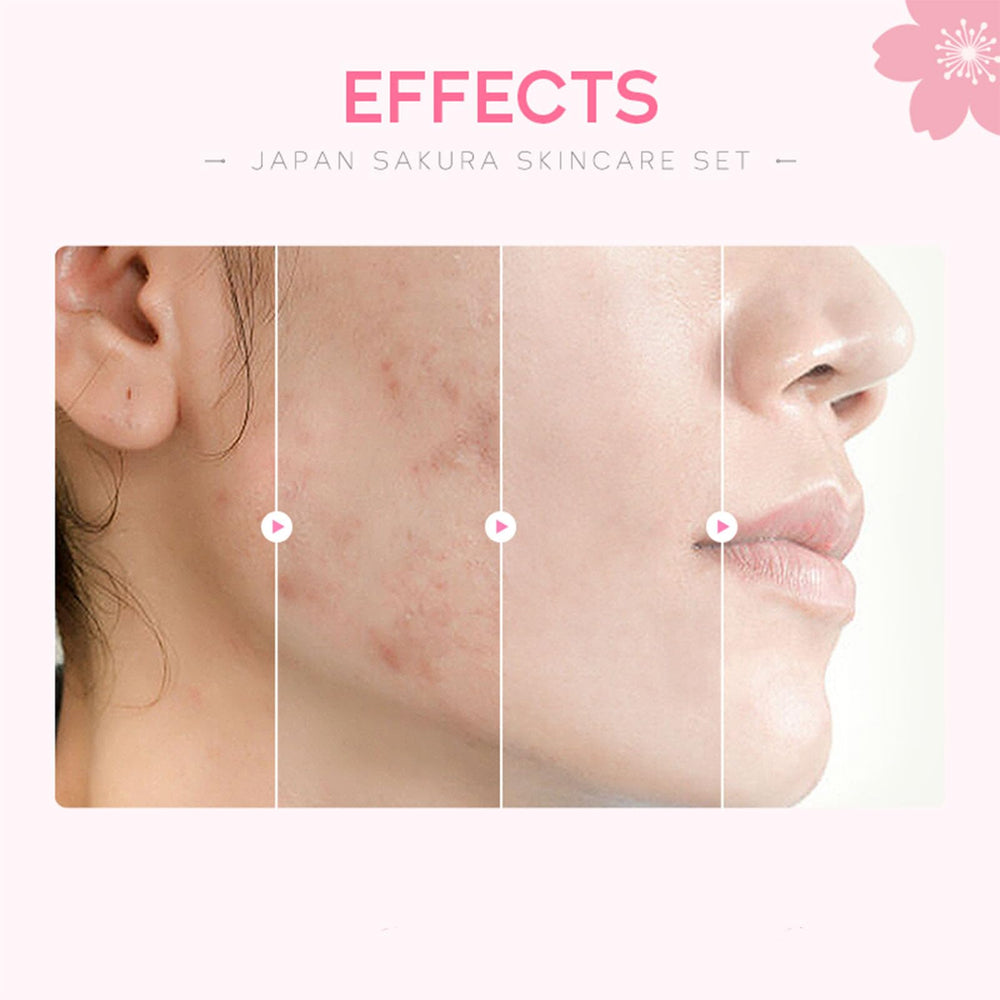 Etuanxi Cherry Skincare Gift Set Box presented as a thoughtful beauty gift