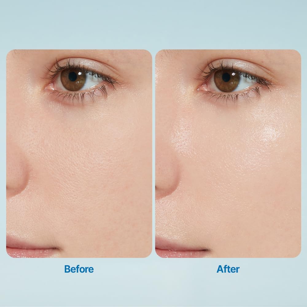 ETUDE SoonJung product used as daily moisturizer for sensitive skin